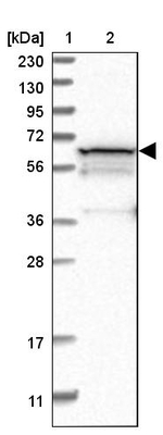 PGM1 Antibody in Western Blot (WB)