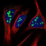 RRP15 Polyclonal Antibody