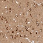 RRP15 Antibody in Immunohistochemistry (Paraffin) (IHC (P))