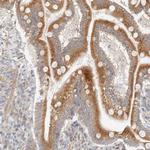 RRP15 Antibody in Immunohistochemistry (Paraffin) (IHC (P))
