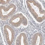 RRP15 Antibody in Immunohistochemistry (Paraffin) (IHC (P))