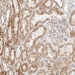RRP15 Antibody in Immunohistochemistry (Paraffin) (IHC (P))