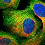 PPP1R12B Polyclonal Antibody