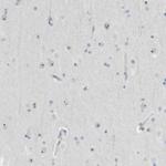 BXDC5 Antibody in Immunohistochemistry (Paraffin) (IHC (P))