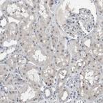 BXDC5 Antibody in Immunohistochemistry (Paraffin) (IHC (P))