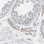 BXDC5 Antibody in Immunohistochemistry (Paraffin) (IHC (P))