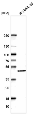 BXDC5 Antibody in Western Blot (WB)