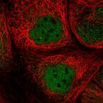 SMCR8 Antibody in Immunocytochemistry (ICC/IF)