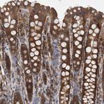 SMCR8 Antibody in Immunohistochemistry (IHC)