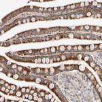 CHADL Polyclonal Antibody