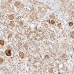 SNTB1 Polyclonal Antibody