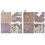 BZRAP1 Antibody in Immunohistochemistry (IHC)