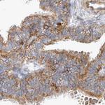 BZRAP1 Antibody in Immunohistochemistry (IHC)
