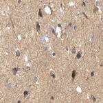 BZRAP1 Antibody in Immunohistochemistry (IHC)