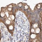 BZRAP1 Antibody in Immunohistochemistry (IHC)