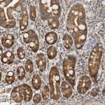GINS4 Antibody in Immunohistochemistry (Paraffin) (IHC (P))