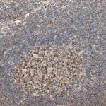 GINS4 Antibody in Immunohistochemistry (Paraffin) (IHC (P))