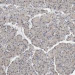 GINS4 Antibody in Immunohistochemistry (Paraffin) (IHC (P))