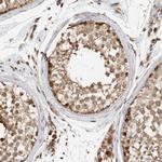 GINS4 Antibody in Immunohistochemistry (Paraffin) (IHC (P))