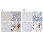 Actin-like 7B Polyclonal Antibody