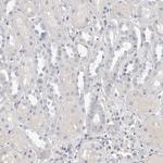 Actin-like 7B Antibody in Immunohistochemistry (IHC)