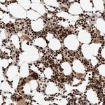 ID3 Antibody in Immunohistochemistry (Paraffin) (IHC (P))