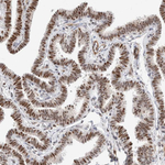 ID3 Antibody in Immunohistochemistry (Paraffin) (IHC (P))