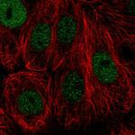 NFKBIL2 Polyclonal Antibody