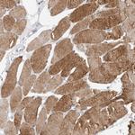 NFKBIL2 Antibody in Immunohistochemistry (Paraffin) (IHC (P))