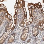 Carbonic Anhydrase XIII Polyclonal Antibody