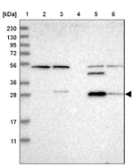 Carbonic Anhydrase XIII Antibody in Western Blot (WB)