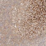 RABEP1 Polyclonal Antibody