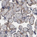 ACSF2 Antibody in Immunohistochemistry (Paraffin) (IHC (P))