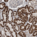 ACSF2 Antibody in Immunohistochemistry (Paraffin) (IHC (P))