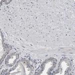 ACSF2 Antibody in Immunohistochemistry (Paraffin) (IHC (P))