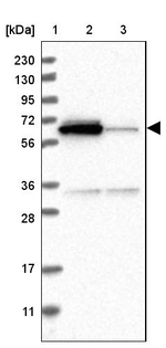 ACSF2 Antibody in Western Blot (WB)