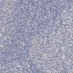 Gephyrin Antibody in Immunohistochemistry (IHC)