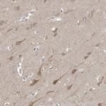 Gephyrin Antibody in Immunohistochemistry (IHC)