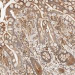 TACC1 Polyclonal Antibody