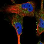 VPS37A Polyclonal Antibody