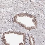 VPS37A Antibody in Immunohistochemistry (IHC)