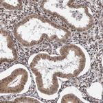 VPS37A Antibody in Immunohistochemistry (IHC)