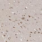 VPS37A Antibody in Immunohistochemistry (IHC)