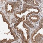 CRISPLD1 Polyclonal Antibody