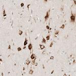 CGI-62 Antibody in Immunohistochemistry (Paraffin) (IHC (P))