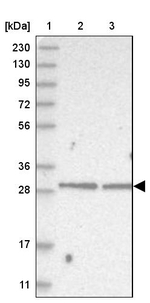 CGI-62 Antibody in Western Blot (WB)