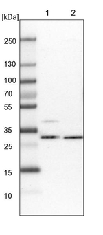 CGI-62 Antibody in Western Blot (WB)