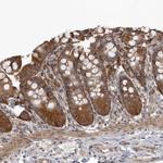 SNX16 Polyclonal Antibody