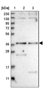 SNX16 Antibody in Western Blot (WB)