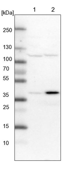 SNX16 Antibody in Western Blot (WB)